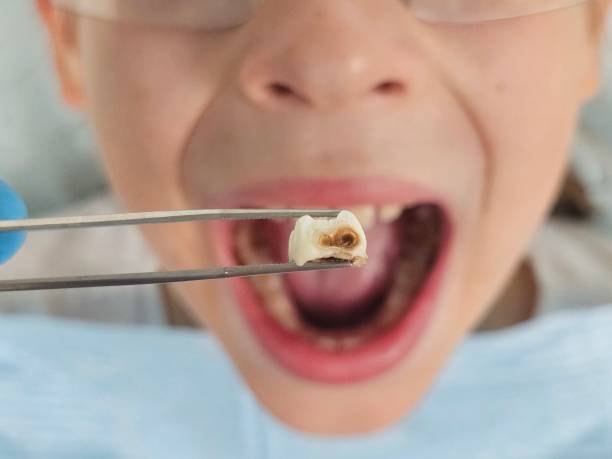 Best Emergency Treatment for Oral Infections in Rocky Point, NC